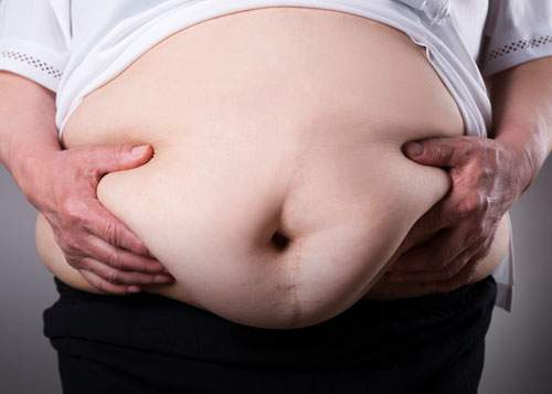 [caption:Bariatric Surgery] Click to go to the Bariatric Surgery page